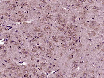 VPS45A Rabbit Polyclonal Antibody