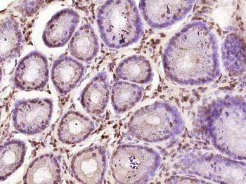 ZNF569 Rabbit Polyclonal Antibody