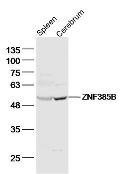 ZNF385B Rabbit Polyclonal Antibody