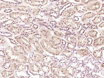 ZNF394 Rabbit Polyclonal Antibody