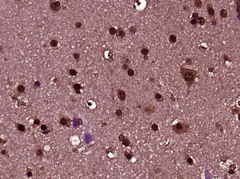 ZNF447 Rabbit Polyclonal Antibody