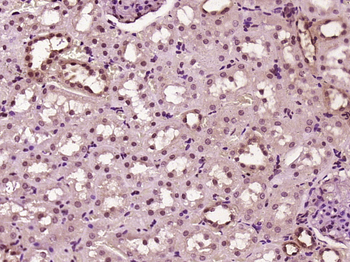 ZNF496 Rabbit Polyclonal Antibody