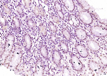 ZNF137 Rabbit Polyclonal Antibody