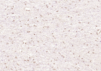 ZNF112 Rabbit Polyclonal Antibody