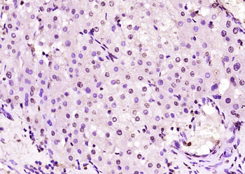 ZNF229 Rabbit Polyclonal Antibody
