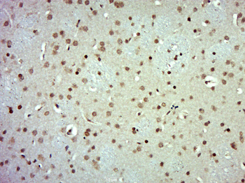 ZNF238 Rabbit Polyclonal Antibody