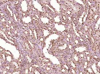 ZNF238 Rabbit Polyclonal Antibody