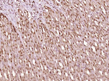 ZNF238 Rabbit Polyclonal Antibody