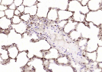 ZNF579 Rabbit Polyclonal Antibody