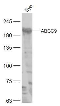 ABCC9 Rabbit Polyclonal Antibody