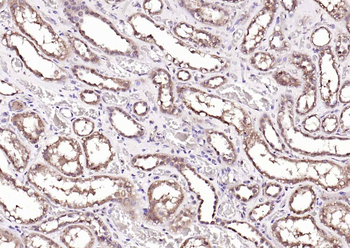 ANKRD54 Rabbit Polyclonal Antibody