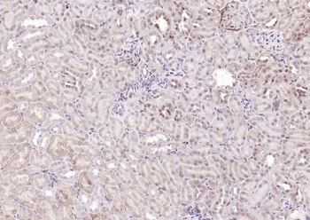ANKRD54 Rabbit Polyclonal Antibody