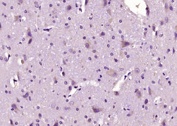 GRK3 Rabbit Polyclonal Antibody