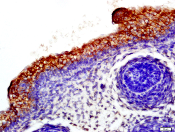 CD19 Rabbit Polyclonal Antibody