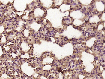 COUP-TF1 Rabbit Polyclonal Antibody