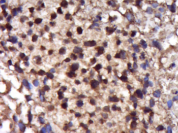 Phospho-Cofilin (Ser3) Rabbit Polyclonal Antibody