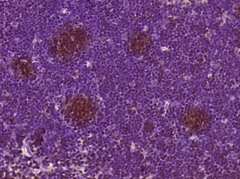 DEF6/IBP Rabbit Polyclonal Antibody