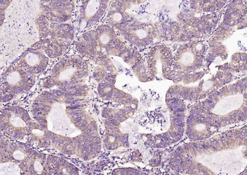 HSD11B2 Rabbit Polyclonal Antibody