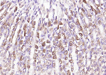 HSD11B2 Rabbit Polyclonal Antibody