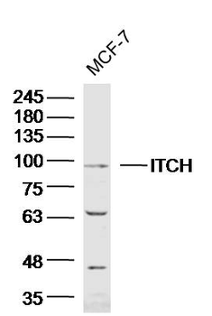 ITCH/AIP4 Rabbit Polyclonal Antibody