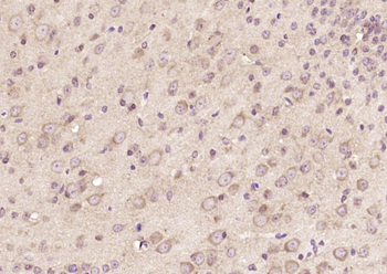 OLFML1 Rabbit Polyclonal Antibody