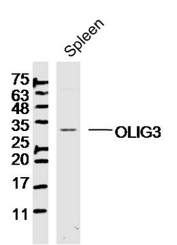 OLIG3 Rabbit Polyclonal Antibody