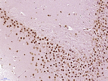 PUS7L Rabbit Polyclonal Antibody