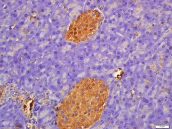 Phospho-PFKM/PFK1 (Ser775) Rabbit Polyclonal Antibody