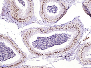 RAD51AP2 Rabbit Polyclonal Antibody