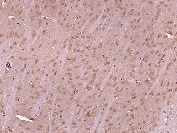 RALGAPB/p170 Rabbit Polyclonal Antibody