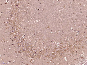 RANBP16/Exp7 Rabbit Polyclonal Antibody