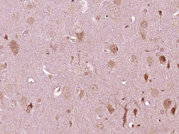 RAP1GAP2 Rabbit Polyclonal Antibody