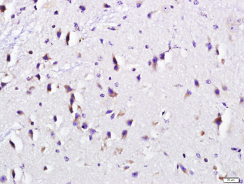 RCAS1/EBAG9 Rabbit Polyclonal Antibody