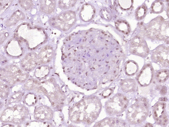 SFRS17A Rabbit Polyclonal Antibody