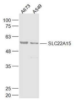 SLC22A15 Rabbit Polyclonal Antibody