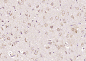 SLC25A1 Rabbit Polyclonal Antibody