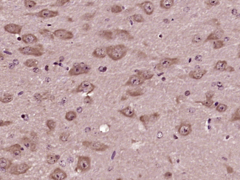 SLC25A33 Rabbit Polyclonal Antibody