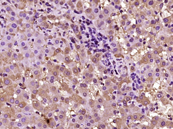 SLC30A5 Rabbit Polyclonal Antibody