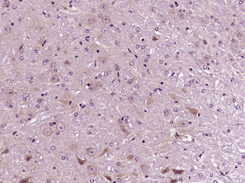 SLC35B4 Rabbit Polyclonal Antibody