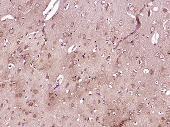 SLC36A2 Rabbit Polyclonal Antibody