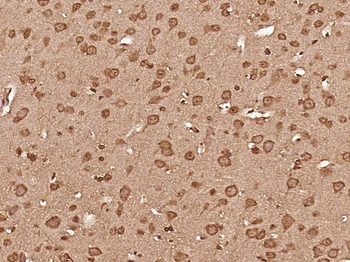 Syntaxin-1B Rabbit Polyclonal Antibody