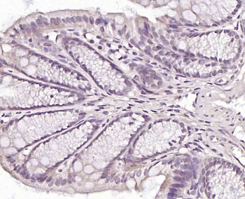 ZNF710 Rabbit Polyclonal Antibody
