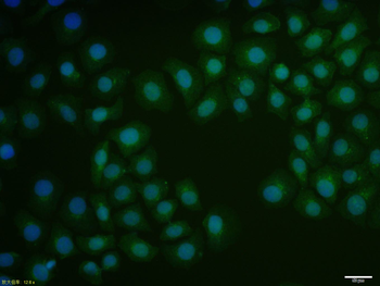 AHR Rabbit Polyclonal Antibody