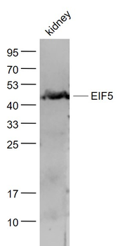 EIF5 Rabbit Polyclonal Antibody