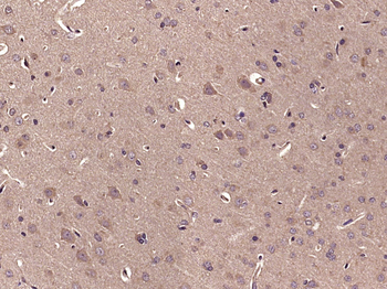 Phospho-c-Abl (Thr735) Rabbit Polyclonal Antibody