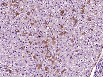 ACOX2 Rabbit Polyclonal Antibody