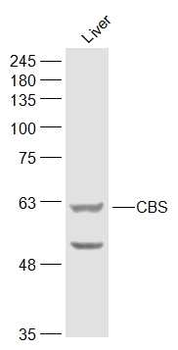 CBS Rabbit Polyclonal Antibody