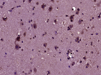 LYRIC Rabbit Polyclonal Antibody