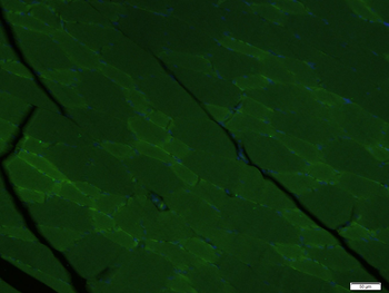 Alpha Dystroglycan Rabbit Polyclonal Antibody