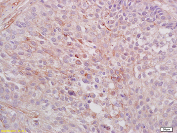 AXL Rabbit Polyclonal Antibody